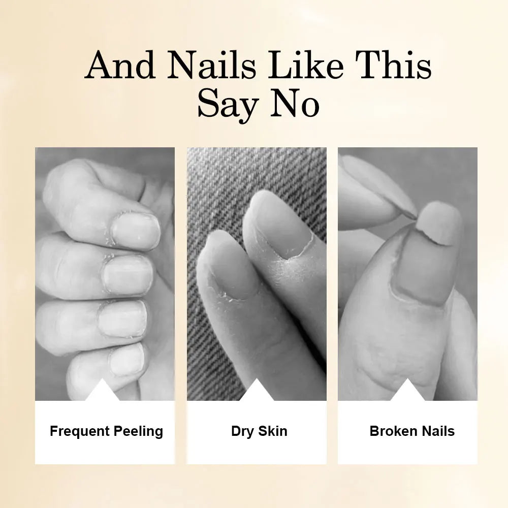 8ml Nail Nutrition Oil Pen 6