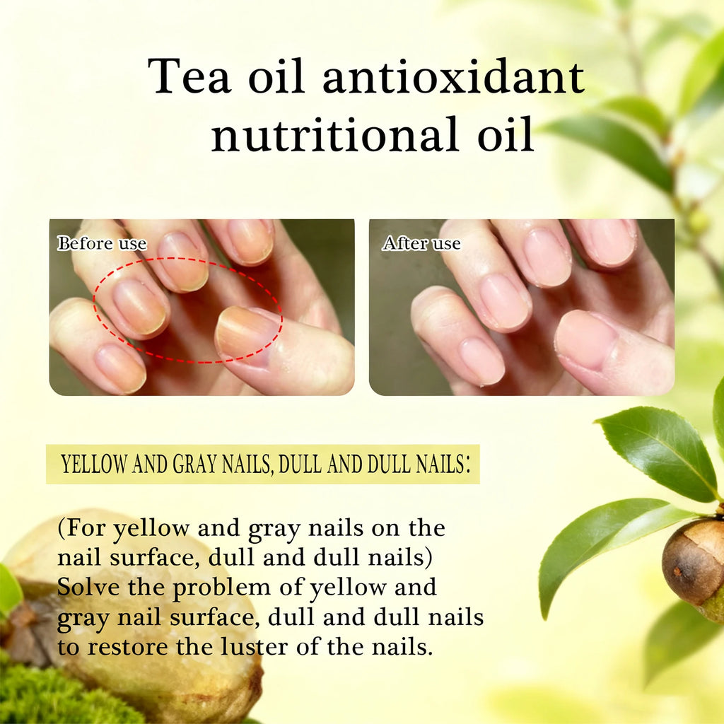 Nail Tea Oil Antioxidant Nutritional Oil